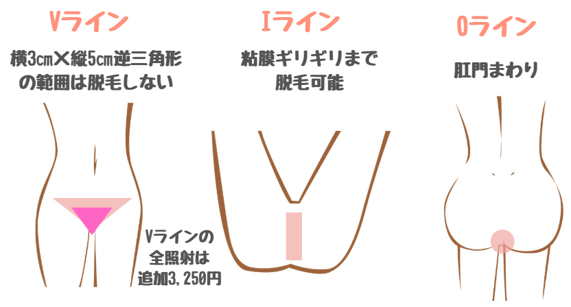 椿クリニックは安い 評判や料金を8院と徹底比較してわかった4つのメリット しろねこ脱毛