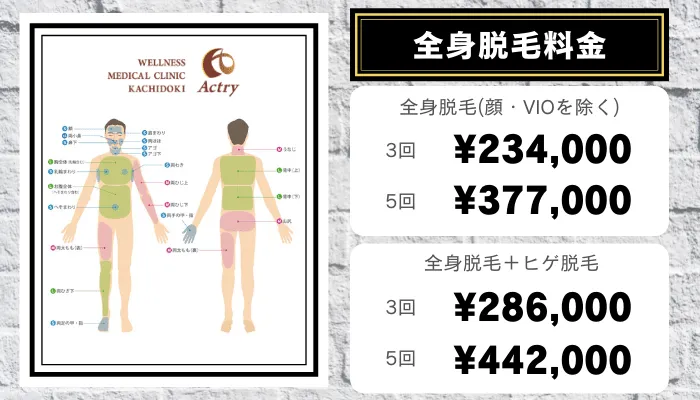 アクトリーメンズ全身脱毛料金