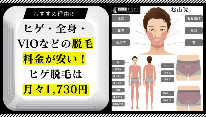 メンズエミナル松山院の脱毛料金や口コミ評判を調査 効果 特徴からわかった通うべき6つの理由 しろねこ脱毛