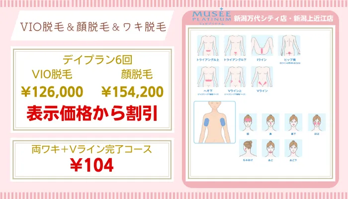 新潟のおすすめ脱毛サロン11選 料金が安い全31店舗を徹底比較しました しろねこ脱毛