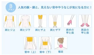 ミュゼ全身脱毛ライトBプラン