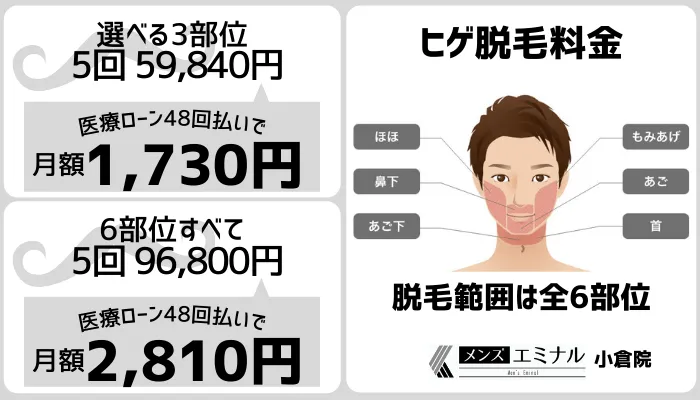 メンズエミナル小倉ヒゲ脱毛料金