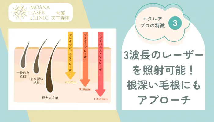 モアナレーザークリニックエクレアプロの特徴3